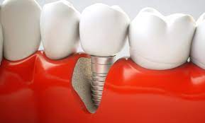 Dental Clinic Sidney, B.C.